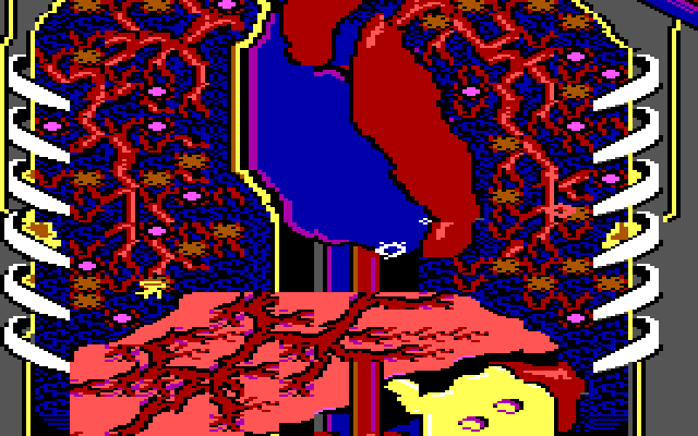 Microsurgeon IBM PC/Compatibles Screenshot: I'm under attack!