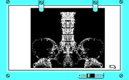 Life & Death for IBM PC/Compatibles - An X-ray doesn't reveal any problems.
