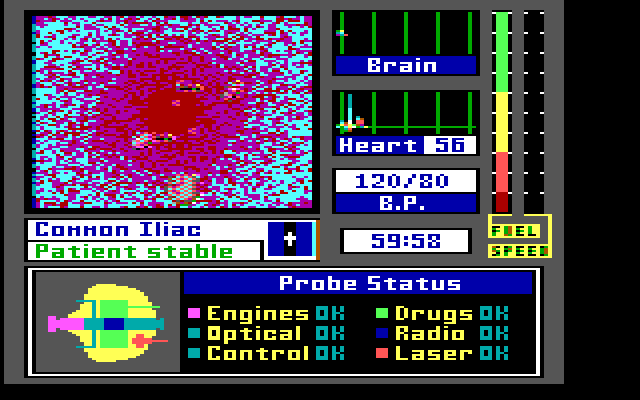 Laser Surgeon: The Microscopic Mission IBM PC/Compatibles Screenshot: The game begins.