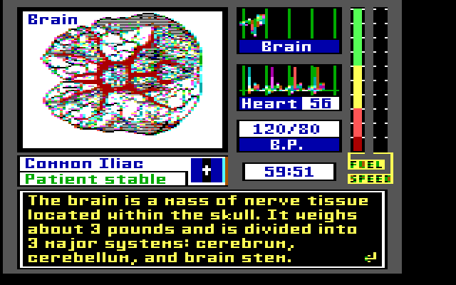 Laser Surgeon: The Microscopic Mission IBM PC/Compatibles Screenshot: About the brain.