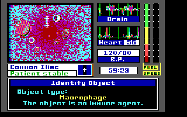 Laser Surgeon: The Microscopic Mission IBM PC/Compatibles Screenshot: Object is a macrophage...