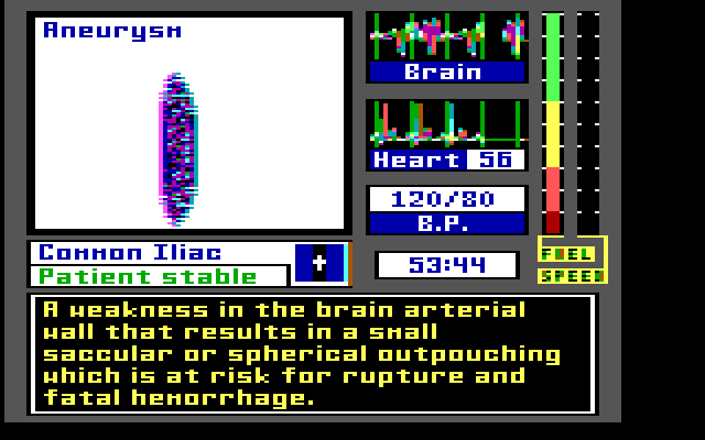 Laser Surgeon: The Microscopic Mission IBM PC/Compatibles Screenshot: Hopefully my patient doesn't have an aneurysm...