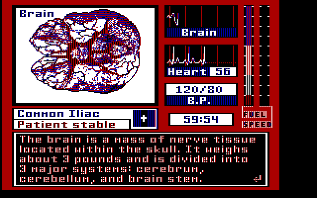 Laser Surgeon: The Microscopic Mission IBM PC/Compatibles Screenshot: About the brain.