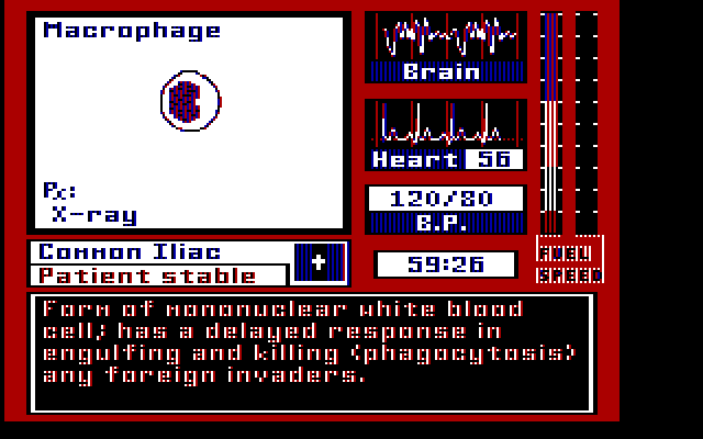 Laser Surgeon: The Microscopic Mission IBM PC/Compatibles Screenshot: About macrophage...