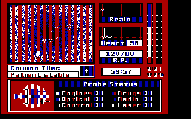 Laser Surgeon: The Microscopic Mission IBM PC/Compatibles Screenshot: The game begins.