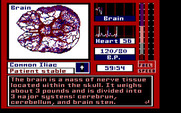 Laser Surgeon: The Microscopic Mission for IBM PC/Compatibles - About the brain.