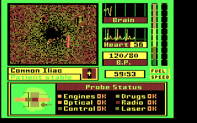 Laser Surgeon: The Microscopic Mission IBM PC/Compatibles Screenshot: The game begins...