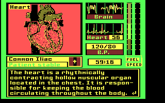 Laser Surgeon: The Microscopic Mission IBM PC/Compatibles Screenshot: More information on the heart...
