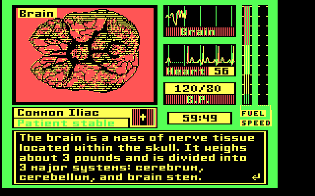 Laser Surgeon: The Microscopic Mission IBM PC/Compatibles Screenshot: About the brain...