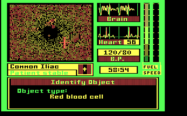 Laser Surgeon: The Microscopic Mission IBM PC/Compatibles Screenshot: Zooming in on red blood cells...