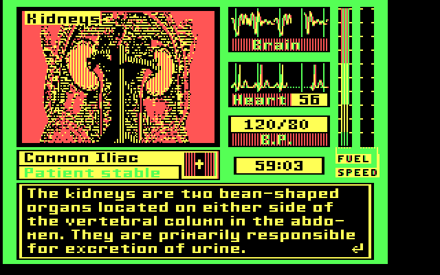 Laser Surgeon: The Microscopic Mission IBM PC/Compatibles Screenshot: The kidneys...