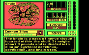 Laser Surgeon: The Microscopic Mission for IBM PC/Compatibles - About the brain...
