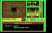 Laser Surgeon: The Microscopic Mission for IBM PC/Compatibles - Zooming in on red blood cells...